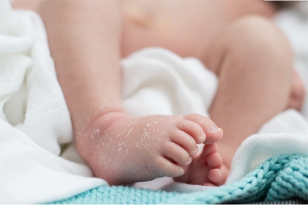 Łuszcząca się skóra u noworodka – naturalne zjawisko, czy powód do niepokoju?